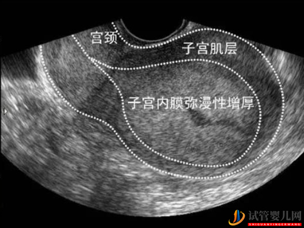 amh0.34储备功能还没衰竭(图1)