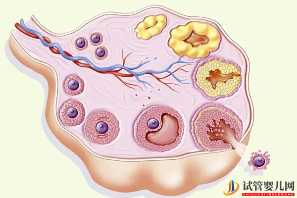 排卵障碍做试管选择合适方案能提高怀孕率(图1)