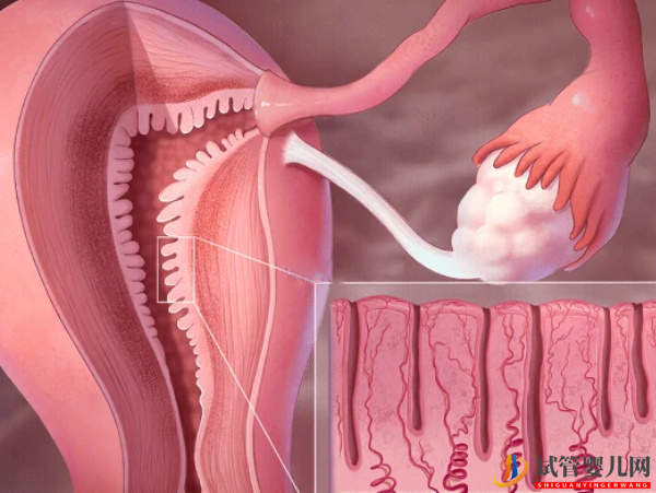 子宫内膜厚对试管的影响别忽视，要不要刮宫？(图1)