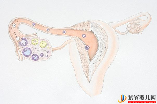 输卵管通而不畅想做试管得先做手术(图2)