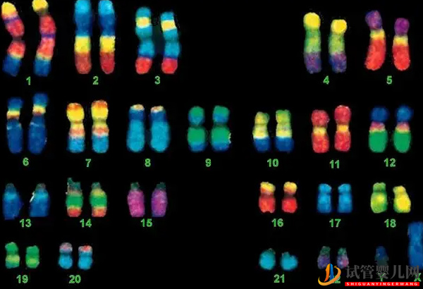 4号染色体异常的后果 - 缺失综合征、三体重复的原因分析(图2)