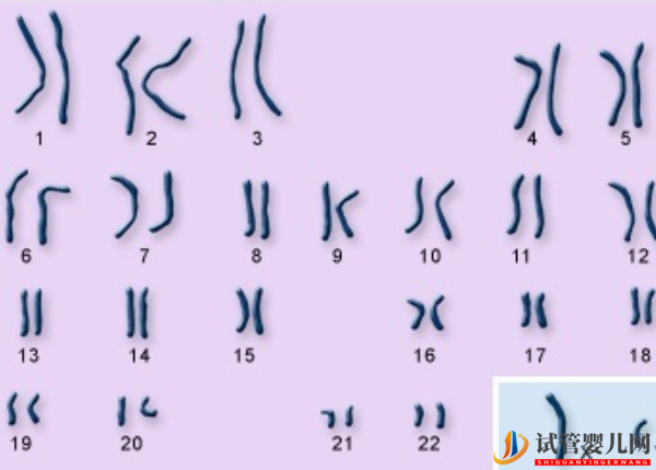 1号染色体异常的后果 - 片段重复、微缺失孩子相关疾病汇总(图1)