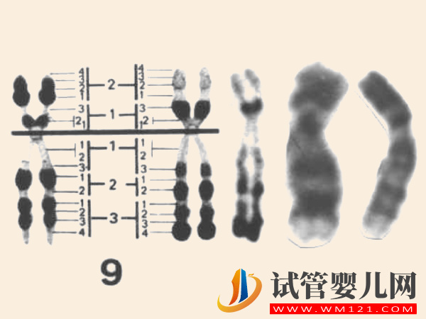 9号染色体决定什么：出现嵌合、三体等异常后果很严重(图1)