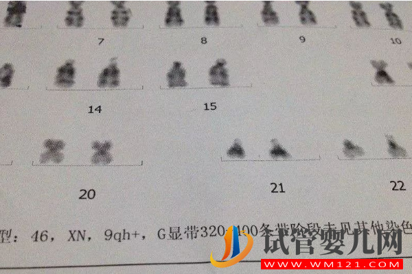 9号染色体决定什么：出现嵌合、三体等异常后果很严重(图2)