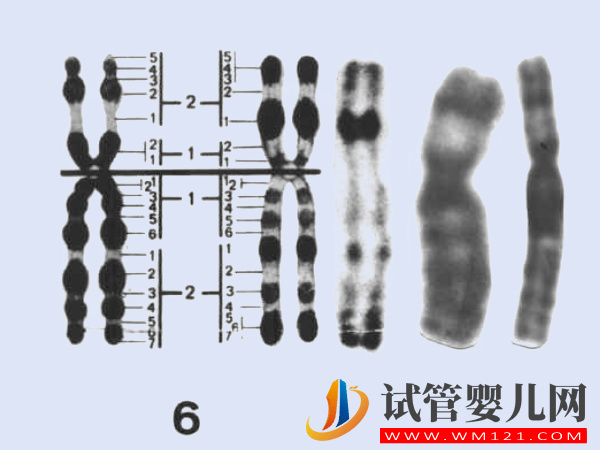 6号染色体缺失、重复相关疾病汇总，不同异常对宝宝影响不一(图1)