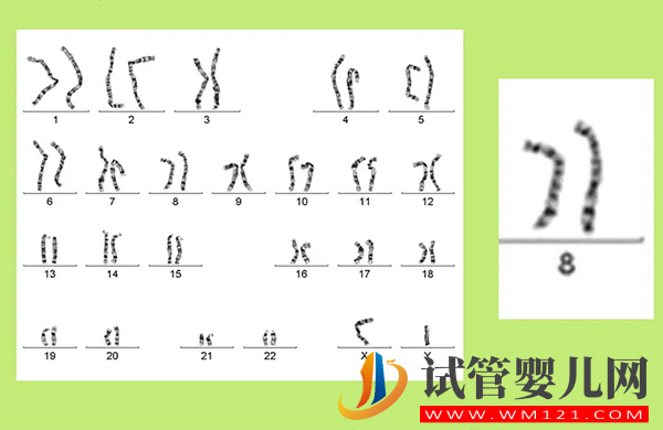 8号染色体异常会怎样 偏多、缺失、三体是什么原因(图1)