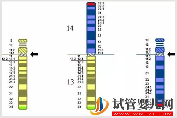 详解女方罗氏易位遗传规律，生育男孩也有概率被遗传(图2)