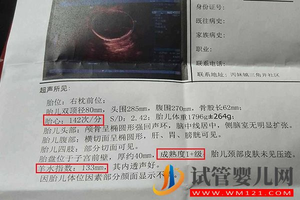 bpd、hc、ac、fl正常值对照表一览，附B超数据看男女方法(图2)