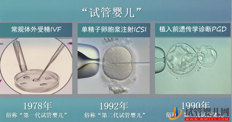 试管婴儿技术走到了哪一步？专家解答→(图4)