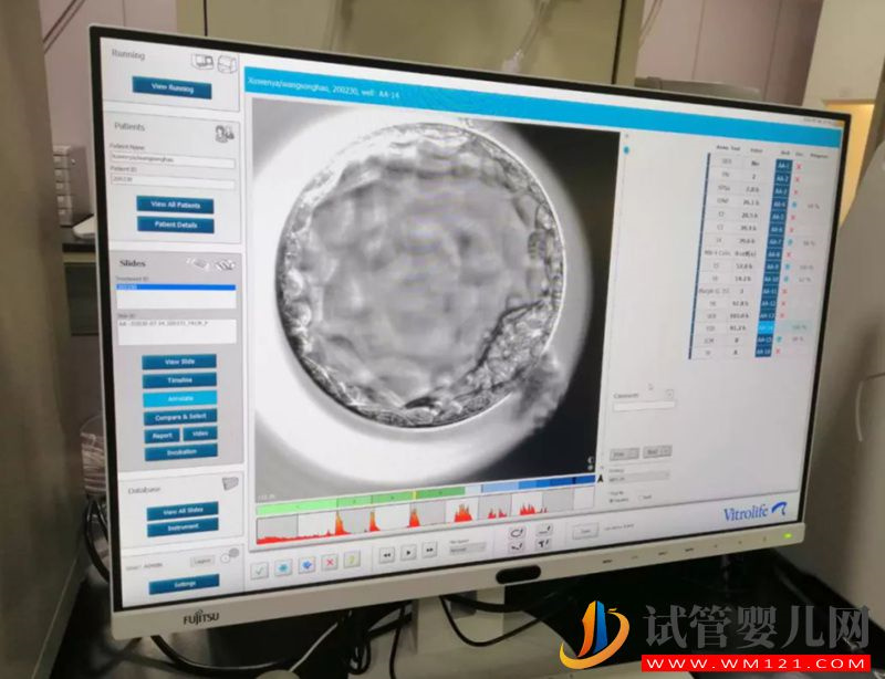 试管宝宝的“家”是怎样的？ 走进胚胎实验室一探究竟(图2)