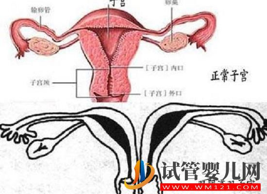 带你了解什么是纵膈子宫，别再和双子宫搞混了(图1)