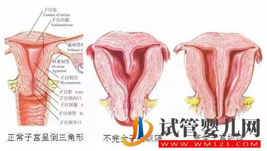 带你了解什么是纵膈子宫，别再和双子宫搞混了(图2)