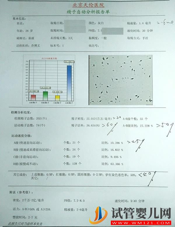 常规精液检查(图1)