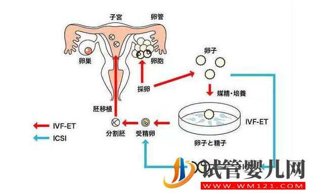 试管婴儿移植后胚胎着床是什么感觉？(图1)