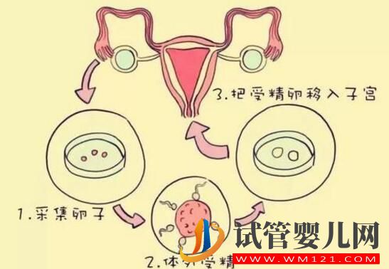 哪些因素影响试管婴儿移植的成功？(图2)