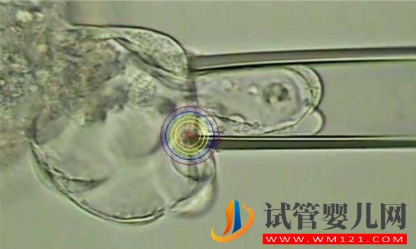 人工授精多次失败后还可以做试管婴儿吗?(图5)