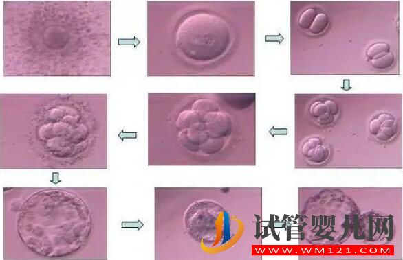 胚胎碎片率的变化对试管婴儿意味着什么(图2)