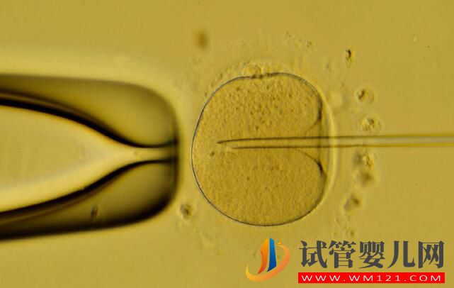 做试管婴儿之后再次自然怀孕是怎么回事(图1)
