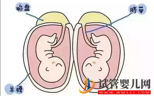 怎么样怀双胞胎的概率更大 有什么好的方法吗(图1)