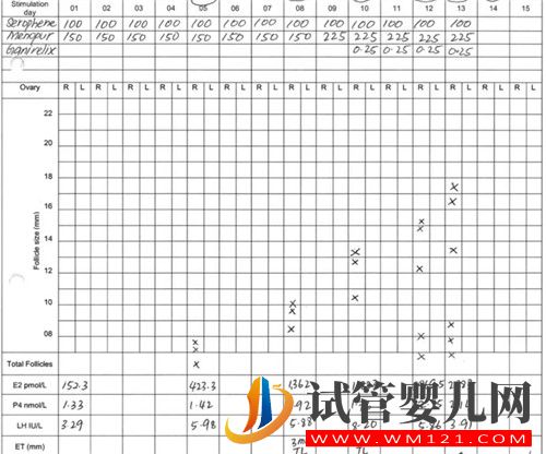 左侧卵巢被割除、三次试管失败她该怎么办？(图5)