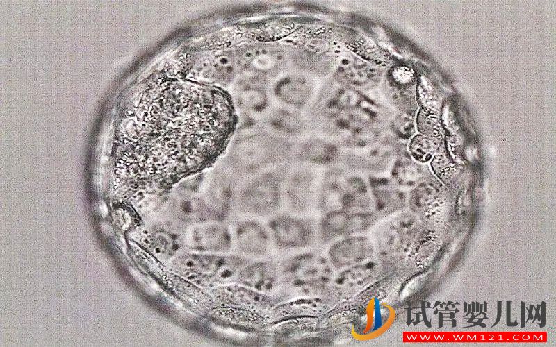 做试管养囊失败的原因有哪些(图1)