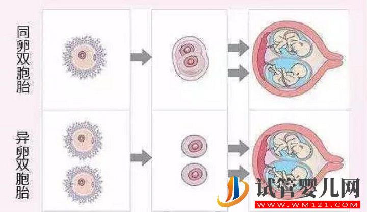 生同卵双胞胎决定性因素分析，来对照下你中了几点？(图2)