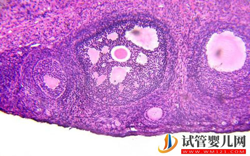 33岁卵巢amh值在多少才没有问题?(图1)