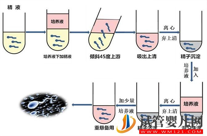 云浮男性hiv通过洗精可以生出健康的女儿吗？(图2)