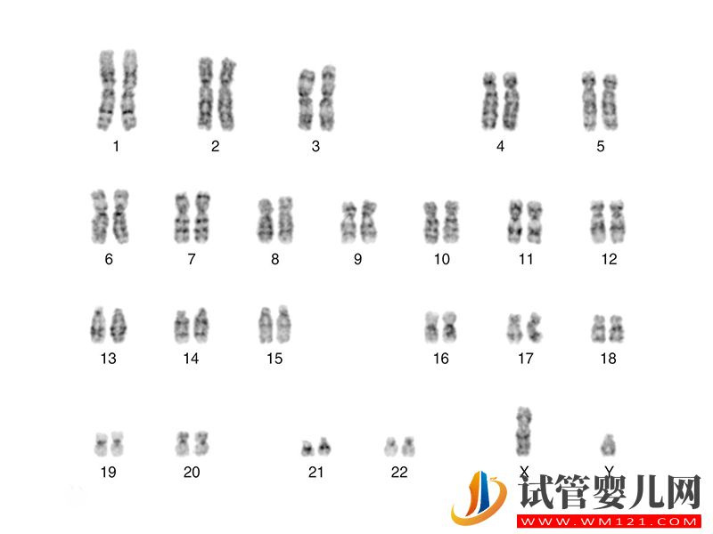 克氏综合征易导致第三性别，竟都是染色体XXY闯的祸(图1)