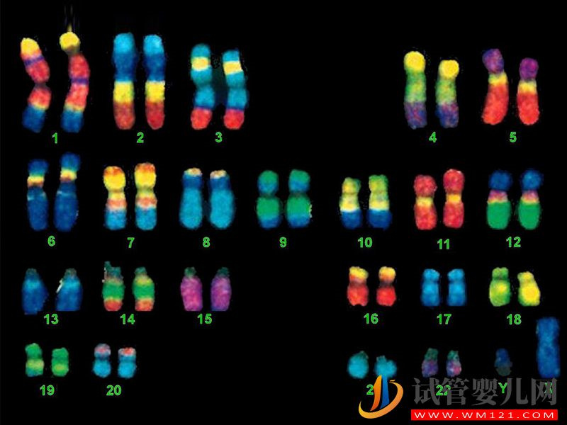 克氏综合征易导致第三性别，竟都是染色体XXY闯的祸(图2)