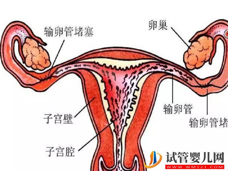 输卵管堵塞致受孕困难很苦恼，试管婴儿助孕当真有效？(图1)