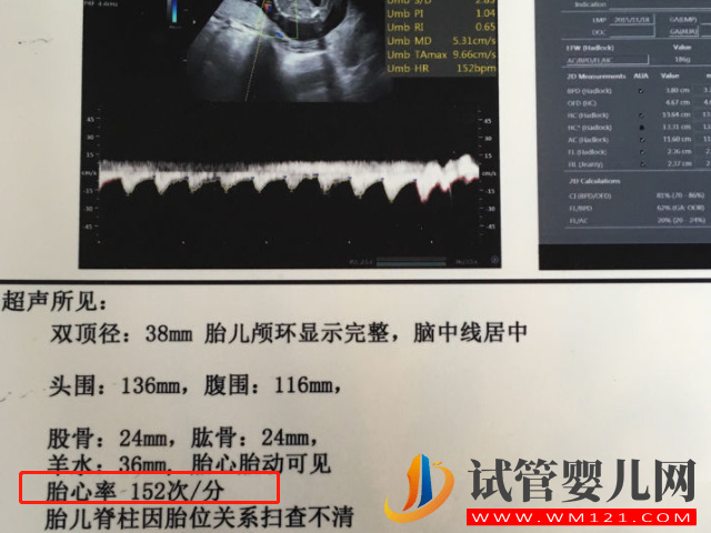 孕8-40周胎心对照表，男宝与女宝的胎心率大不同(图2)