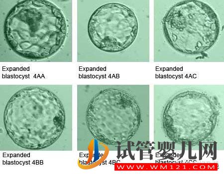 胚胎质量好,移植却频频失败 什么原因造成？(图1)