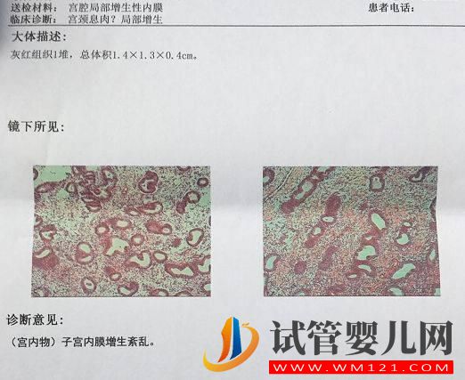 试管婴儿多次移植不着床或生化,怎么办(图5)