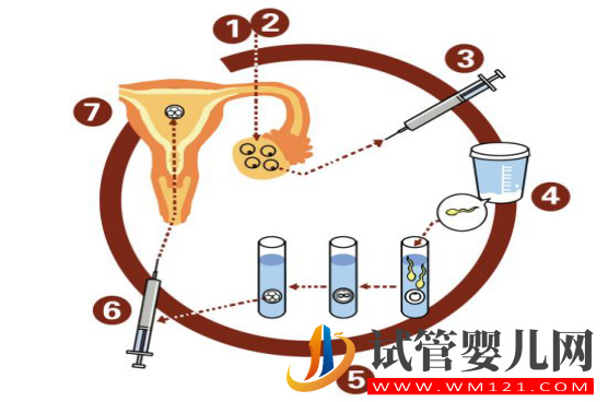 试管婴儿移植前的准备工作(图1)