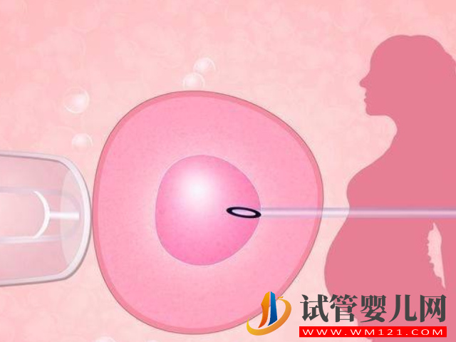 男性hiv通过试管可以生出健康宝宝吗？(图2)