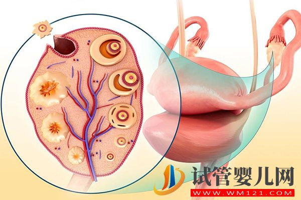 试管卵泡发育慢用短方案促排，效果不佳试试这些调理方法(图1)