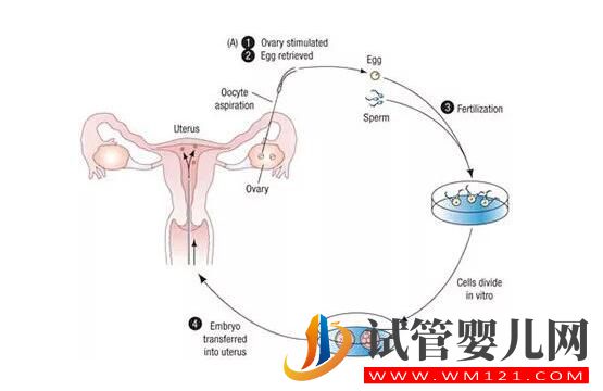试管婴儿移植后早期着床有什么反应呢(图1)