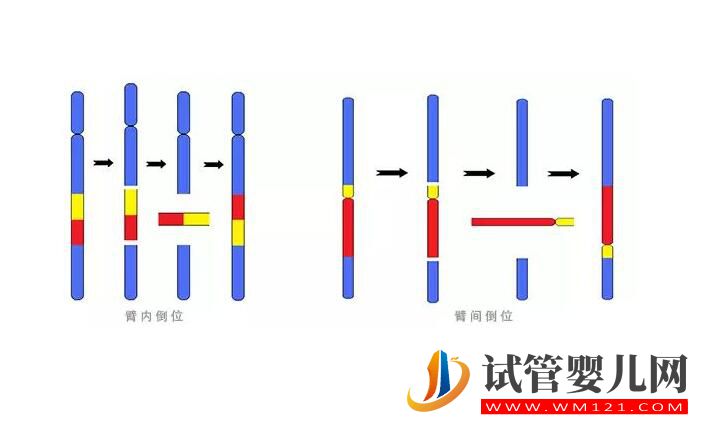 染色体平衡易位能做试管手术吗 要注意哪些问题(图2)