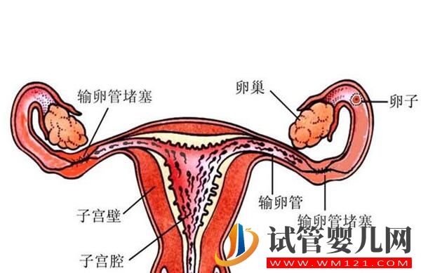 输卵管积水会对试管婴儿成功率造成影响吗?(图1)