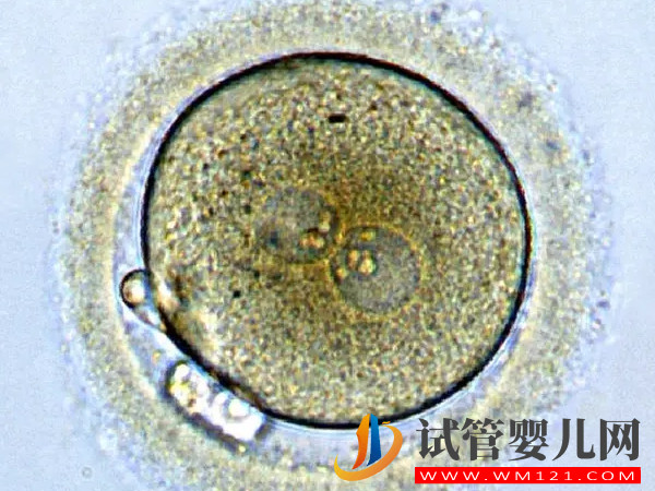 试管2pn胚胎等级大揭秘，来看看和1pn相比哪个好(图1)