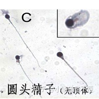 一代试管和二代试管的区别_畸形率高影响试管成功率(图14)