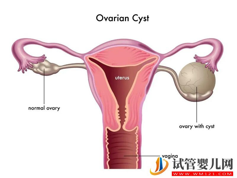 卵巢出现异常会对女性造成什么影响？(图1)