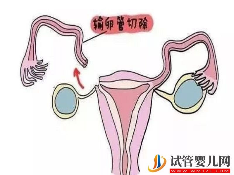 输卵管切除的荥阳备孕女性看过来，这些医院可助你一臂之力(图1)