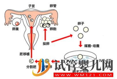 试管适应症_第一代试管婴儿(图3)