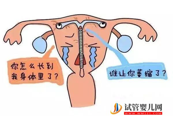 产后什么时间放环及其注意事项(图1)