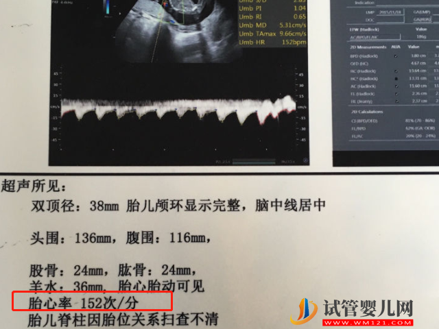 民间最灵预测生男生女方法大揭秘，举例说明包教你看懂！(图4)