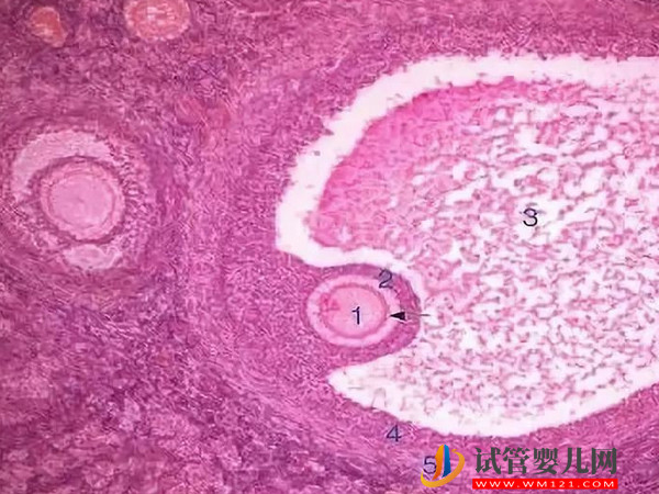 促排空卵泡能否长大到成熟并自然排除(图1)