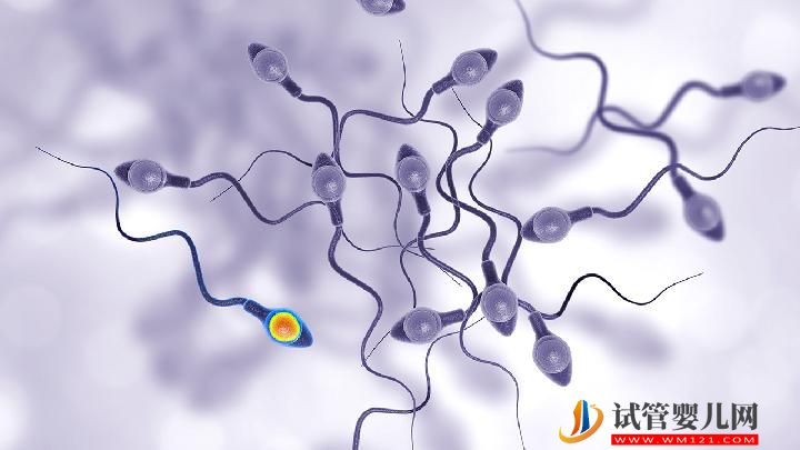 男性不育的原因可总结 警惕生活中有这6大精子杀手(图6)