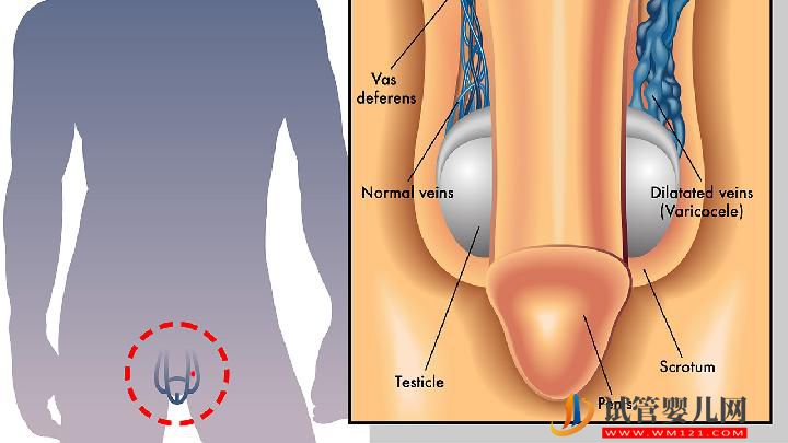 预防男人不育有哪几个禁忌 预防男性不育应牢记5个禁忌(图1)